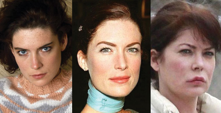 lara-flynn-boyle-plastic-surgery-before-and-after.jpg