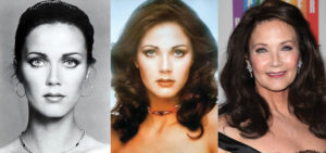 Lynda Carter Plastic Surgery Before And After Pictures 2023