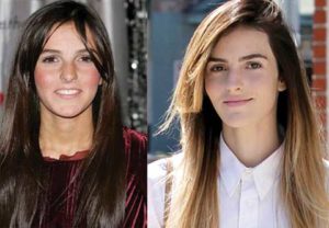 ali lohan plastic surgery before and after photos