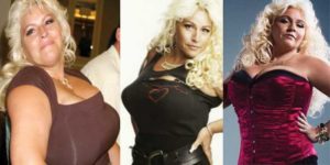beth chapman plastic surgery before and after photos