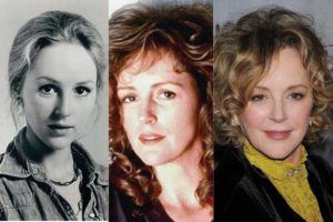 bonnie bedelia plastic surgery before and after photos