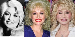 dolly parton plastic surgery before and after photos