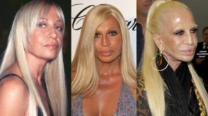 donatella versace plastic surgery before and after photos