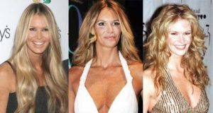 elle macpherson plastic surgery before and after photos