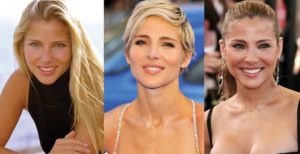 elsa pataky plastic surgery before and after photos
