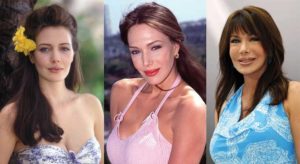 hunter tylo plastic surgery before and after photos