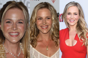 julie benz plastic surgery before and after photos
