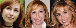 kari byron plastic surgery before and after