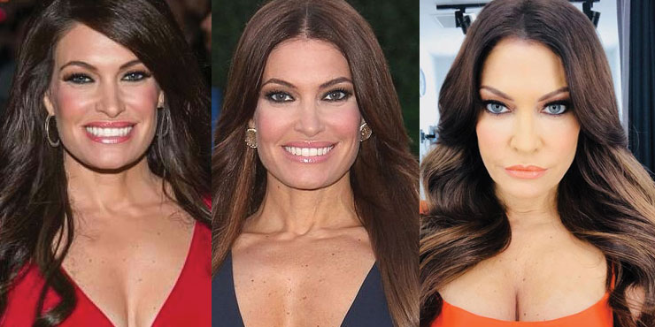 kimberly guilfoyle before and after plastic surgery 2022