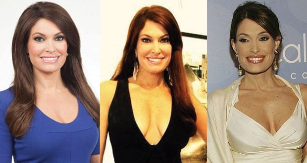 kimberly guilfoyle plastic surgery before and after photos 2022