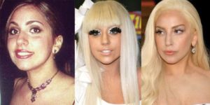 lady gaga plastic surgery before and after