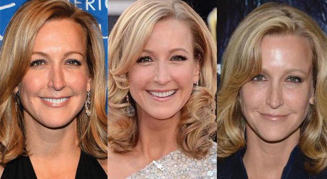 lara spencer plastic surgery before and after 2024