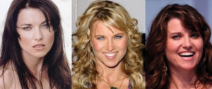 lucy lawless plastic surgery before and after