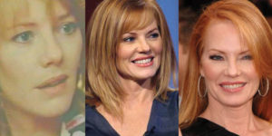 marg helgenberger plastic surgery before and after photos