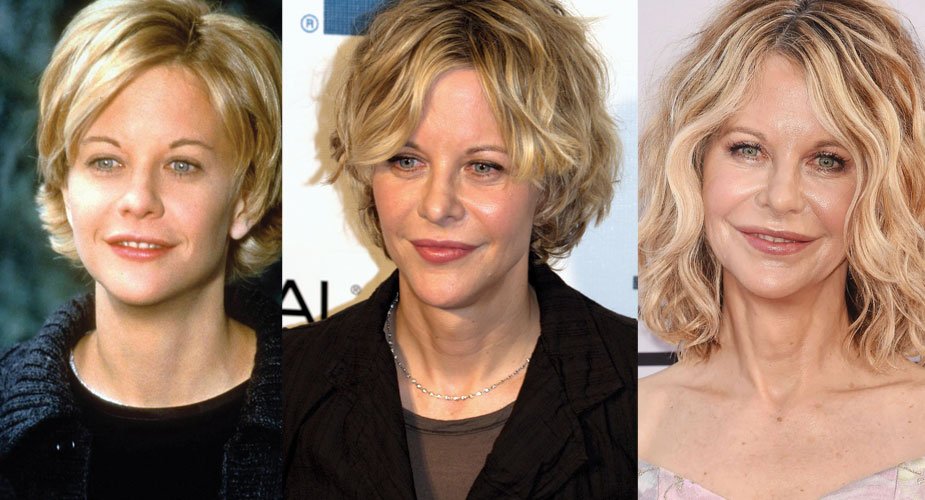 Meg Ryan Plastic Surgery Before and After Pictures 2020