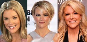 megyn kelly plastic surgery before and after