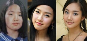 park min young before and after plastic surgery