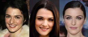 rachel weisz plastic surgery before and after