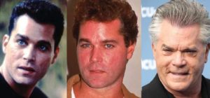 ray liotta plastic surgery before and after