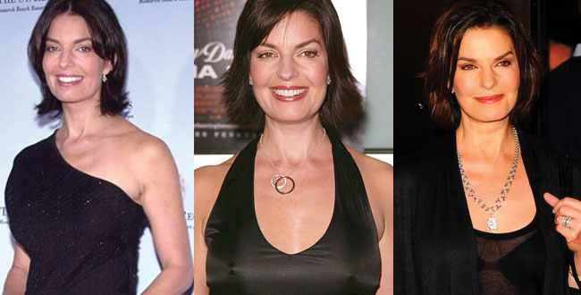 sela ward before and after plastic surgery 2024