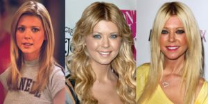 tara reid plastic surgery before and after