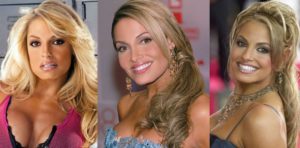 trish stratus plastic surgery before and after